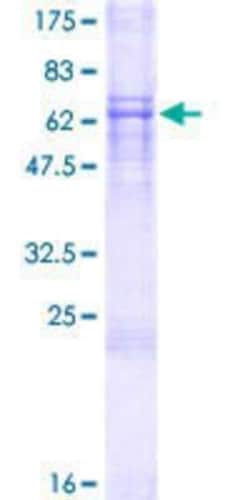 Novus Biologicals Recombinant Human Deleted in azoospermia 4 GST (N-Term) Protein 10 &mu;g | Buy Online | Novus Biologicals&trade; | Fisher Scientific