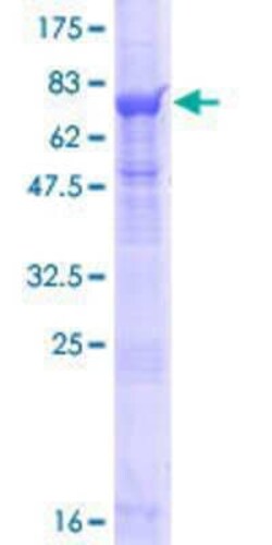 Novus Biologicals Recombinant Human RNPEPL1 GST (N-Term) Protein 25 &mu;g | Buy Online | Novus Biologicals&trade; | Fisher Scientific