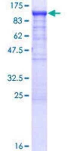 Novus Biologicals Recombinant Human SCY1 like 3 GST (N-Term) Protein 25 &mu;g | Buy Online | Novus Biologicals&trade; | Fisher Scientific