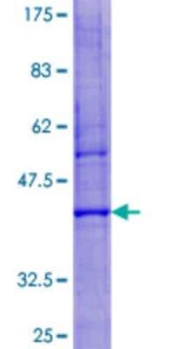 Novus Biologicals&trade;&nbsp;Recombinant Human LYZL6 GST (N-Term) Protein