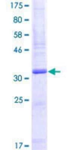 Novus Biologicals&trade;&nbsp;Recombinant Human SLURP1 GST (N-Term) Protein
