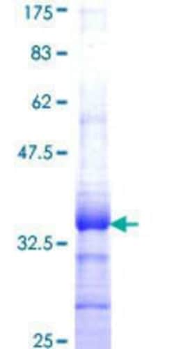 Novus Biologicals&trade;&nbsp;Recombinant Human SLURP1 GST (N-Term) Protein