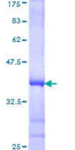 Novus Biologicals Recombinant Human SLC44A2 GST (N-Term) Protein 10 &mu;g | Buy Online | Novus Biologicals&trade; | Fisher Scientific