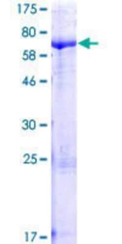 Novus Biologicals Recombinant Human PHTF2 GST (N-Term) Protein 10 &mu;g | Buy Online | Novus Biologicals&trade; | Fisher Scientific