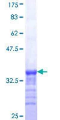 Novus Biologicals Recombinant Human MURF3 GST (N-Term) Protein 10 &mu;g | Buy Online | Novus Biologicals&trade; | Fisher Scientific