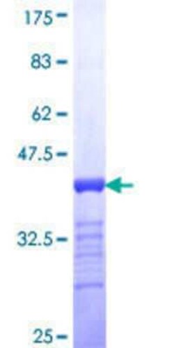Novus Biologicals Recombinant Human SALL4 GST (N-Term) Protein 10 &mu;g | Buy Online | Novus Biologicals&trade; | Fisher Scientific