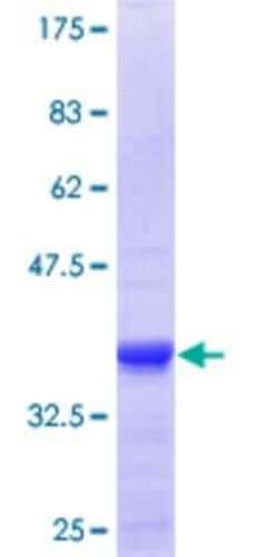 Novus Biologicals Recombinant Human ZNFX1 GST (N-Term) Protein 25 &mu;g | Buy Online | Novus Biologicals&trade; | Fisher Scientific