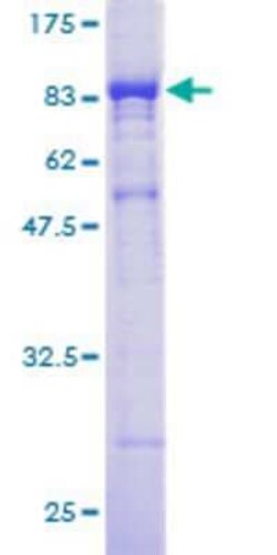 Novus Biologicals Recombinant Human CORO1B GST (N-Term) Protein 2 &mu;g | Buy Online | Novus Biologicals&trade; | Fisher Scientific