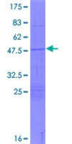 Novus Biologicals Recombinant Human SLC45A4 GST (N-Term) Protein 2 &mu;g | Buy Online | Novus Biologicals&trade; | Fisher Scientific