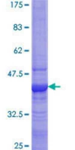 Novus Biologicals Recombinant Human SPRYD7 GST (N-Term) Protein 2 &mu;g | Buy Online | Novus Biologicals&trade; | Fisher Scientific