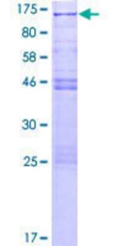 Novus Biologicals Recombinant Human CSRP2BP GST (N-Term) Protein 2 &mu;g | Buy Online | Novus Biologicals&trade; | Fisher Scientific