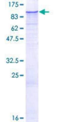 Novus Biologicals Recombinant Human Zinc finger protein 287 GST (N-Term) Protein 25 &mu;g | Buy Online | Novus Biologicals&trade; | Fisher Scientific