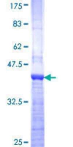 Novus Biologicals Recombinant Human SENP7 GST (N-Term) Protein 10 &mu;g | Buy Online | Novus Biologicals&trade; | Fisher Scientific