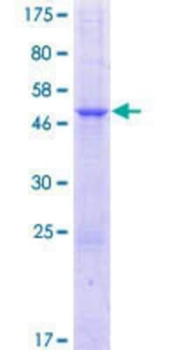 Novus Biologicals Recombinant Human TTYH1 GST (N-Term) Protein 25 &mu;g | Buy Online | Novus Biologicals&trade; | Fisher Scientific
