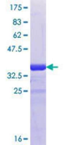 Novus Biologicals Recombinant Human Connexin 36/GJD2 GST (N-Term) Protein 10 &mu;g | Buy Online | Novus Biologicals&trade; | Fisher Scientific