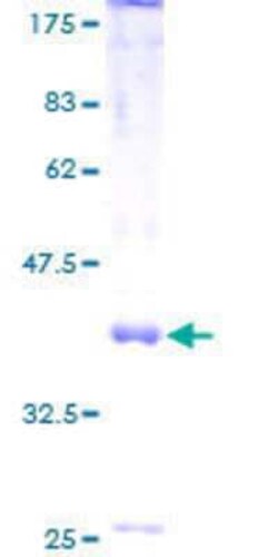 Novus Biologicals Recombinant Human MRS2 GST (N-Term) Protein 10 &mu;g | Buy Online | Novus Biologicals&trade; | Fisher Scientific