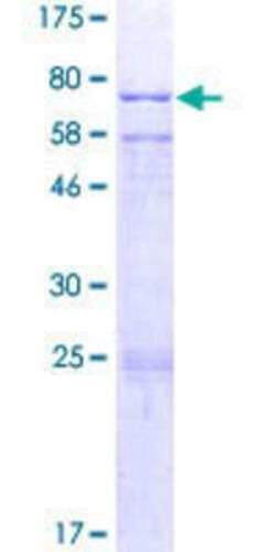Novus Biologicals Recombinant Human CYP20A1 GST (N-Term) Protein 2 &mu;g | Buy Online | Novus Biologicals&trade; | Fisher Scientific