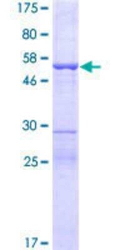 Novus Biologicals Recombinant Human MIF4GD GST (N-Term) Protein 25 &mu;g | Buy Online | Novus Biologicals&trade; | Fisher Scientific
