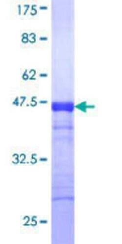 Novus Biologicals Recombinant Human SCYL1 GST (N-Term) Protein 25 &mu;g | Buy Online | Novus Biologicals&trade; | Fisher Scientific