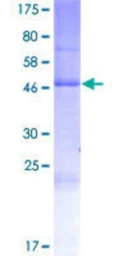 Novus Biologicals Recombinant Human RHBDD2 GST (N-Term) Protein 2 &mu;g | Buy Online | Novus Biologicals&trade; | Fisher Scientific