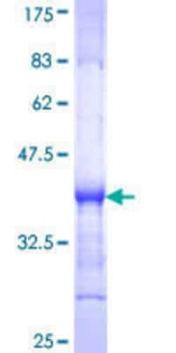 Novus Biologicals Recombinant Human PLEKHG5 GST (N-Term) Protein 25 &mu;g | Buy Online | Novus Biologicals&trade; | Fisher Scientific