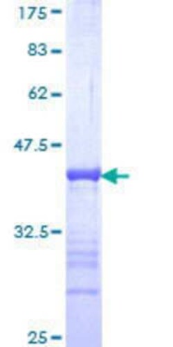 Novus Biologicals Recombinant Human p66 beta GST (N-Term) Protein 10 &mu;g | Buy Online | Novus Biologicals&trade; | Fisher Scientific