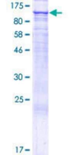 Novus Biologicals Recombinant Human FAM40B GST (N-Term) Protein 25 &mu;g | Buy Online | Novus Biologicals&trade; | Fisher Scientific