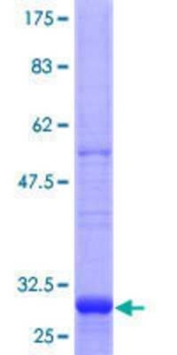 Novus Biologicals Recombinant Human HHATL GST (N-Term) Protein 25 &mu;g | Buy Online | Novus Biologicals&trade; | Fisher Scientific