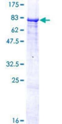 Novus Biologicals Recombinant Human ZNF490 GST (N-Term) Protein 25 &mu;g | Buy Online | Novus Biologicals&trade; | Fisher Scientific