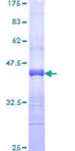 Novus Biologicals Recombinant Human RNF150 GST (N-Term) Protein 25 &mu;g | Buy Online | Novus Biologicals&trade; | Fisher Scientific