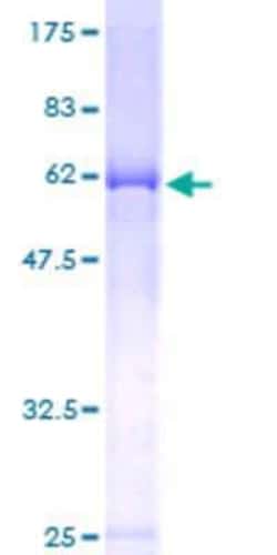 Novus Biologicals Recombinant Human FAM62B GST (N-Term) Protein 10 &mu;g | Buy Online | Novus Biologicals&trade; | Fisher Scientific
