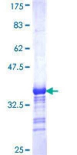 Novus Biologicals Recombinant Human AHRR GST (N-Term) Protein 25 &mu;g | Buy Online | Novus Biologicals&trade; | Fisher Scientific