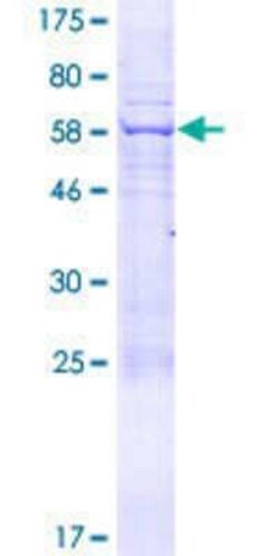 Novus Biologicals Recombinant Human KIAA1257 GST (N-Term) Protein 2 &mu;g | Buy Online | Novus Biologicals&trade; | Fisher Scientific