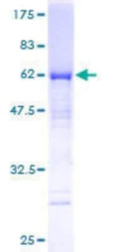 Novus Biologicals Recombinant Human MTUS1 GST (N-Term) Protein 10 &mu;g | Buy Online | Novus Biologicals&trade; | Fisher Scientific
