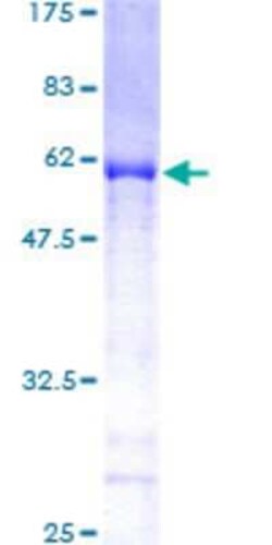 Novus Biologicals Recombinant Human Exportin-5 GST (N-Term) Protein 25 &mu;g | Buy Online | Novus Biologicals&trade; | Fisher Scientific