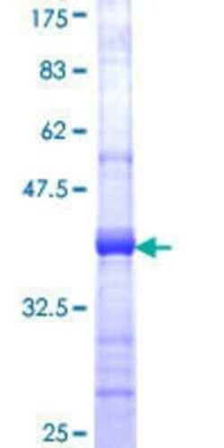 Novus Biologicals Recombinant Human COG6 GST (N-Term) Protein 10 &mu;g | Buy Online | Novus Biologicals&trade; | Fisher Scientific