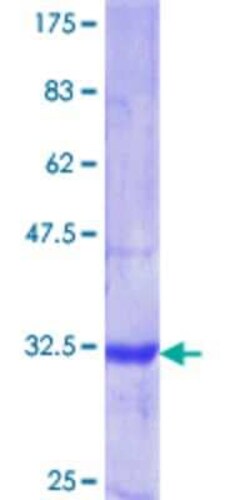 Novus Biologicals Recombinant Human RPTOR GST (N-Term) Protein 10 &mu;g | Buy Online | Novus Biologicals&trade; | Fisher Scientific