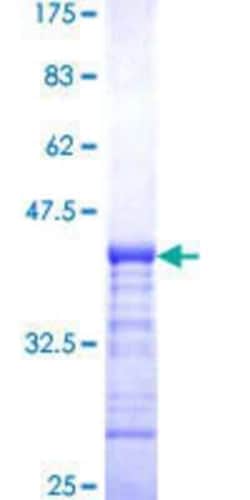 Novus Biologicals Recombinant Human SRGAP1 GST (N-Term) Protein 10 &mu;g | Buy Online | Novus Biologicals&trade; | Fisher Scientific