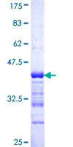 Novus Biologicals Recombinant Human ALPK3 GST (N-Term) Protein 25 &mu;g | Buy Online | Novus Biologicals&trade; | Fisher Scientific