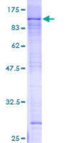 Novus Biologicals Recombinant Human ZNF398 GST (N-Term) Protein 2 &mu;g | Buy Online | Novus Biologicals&trade; | Fisher Scientific
