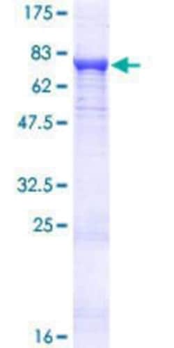 Novus Biologicals Recombinant Human PDP2 GST (N-Term) Protein 10 &mu;g | Buy Online | Novus Biologicals&trade; | Fisher Scientific