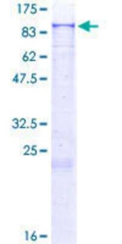 Novus Biologicals Recombinant Human ZNF624 GST (N-Term) Protein 25 &mu;g | Buy Online | Novus Biologicals&trade; | Fisher Scientific