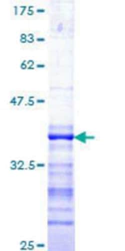 Novus Biologicals Recombinant Human TAO Kinase 1 GST (N-Term) Protein 25 &mu;g | Buy Online | Novus Biologicals&trade; | Fisher Scientific