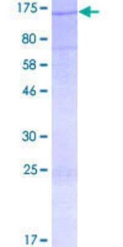 Novus Biologicals Recombinant Human MICAL3 GST (N-Term) Protein 2 &mu;g | Buy Online | Novus Biologicals&trade; | Fisher Scientific