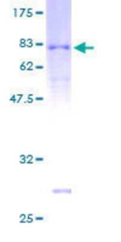 Novus Biologicals Recombinant Human ARRDC3 GST (N-Term) Protein 10 &mu;g | Buy Online | Novus Biologicals&trade; | Fisher Scientific