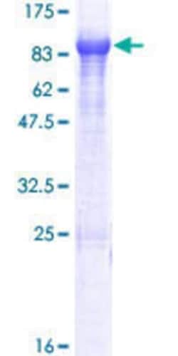 Novus Biologicals Recombinant Human KLHL14 GST (N-Term) Protein 10 &mu;g | Buy Online | Novus Biologicals&trade; | Fisher Scientific