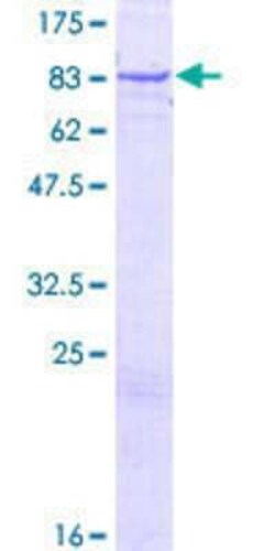Novus Biologicals Recombinant Human ZNF319 GST (N-Term) Protein 10 &mu;g | Buy Online | Novus Biologicals&trade; | Fisher Scientific