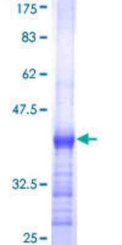 Novus Biologicals&trade;&nbsp;Recombinant Human MARCH4 GST (N-Term) Protein