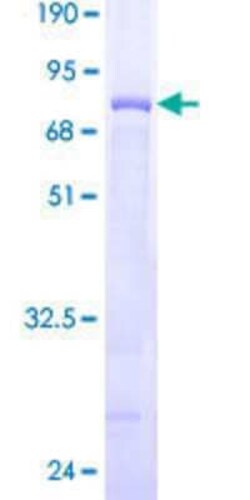 Novus Biologicals Recombinant Human FENS1 GST (N-Term) Protein 25 &mu;g | Buy Online | Novus Biologicals&trade; | Fisher Scientific