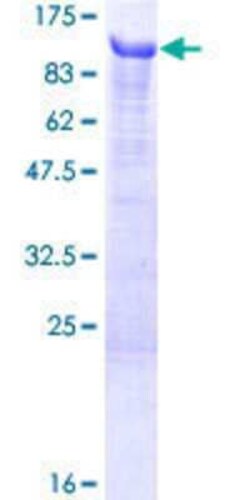 Novus Biologicals Recombinant Human Begain GST (N-Term) Protein 10 &mu;g | Buy Online | Novus Biologicals&trade; | Fisher Scientific
